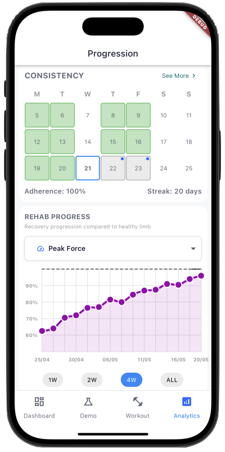Rehab Progress